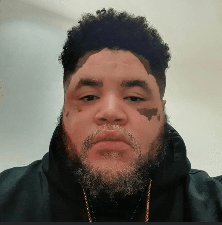 Des Is Conscious, a Black man with vitiligo, wearing a black hoodie, looking towards the camera in a professional portrait.